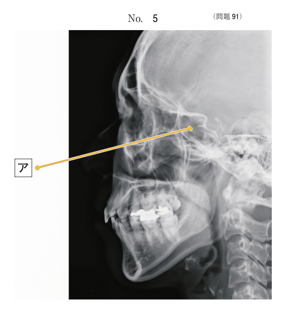 第71回 午後 問91 別冊 No. 5