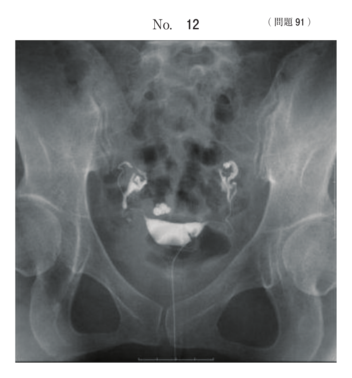 第72回 午前 問91 別冊 No. 12