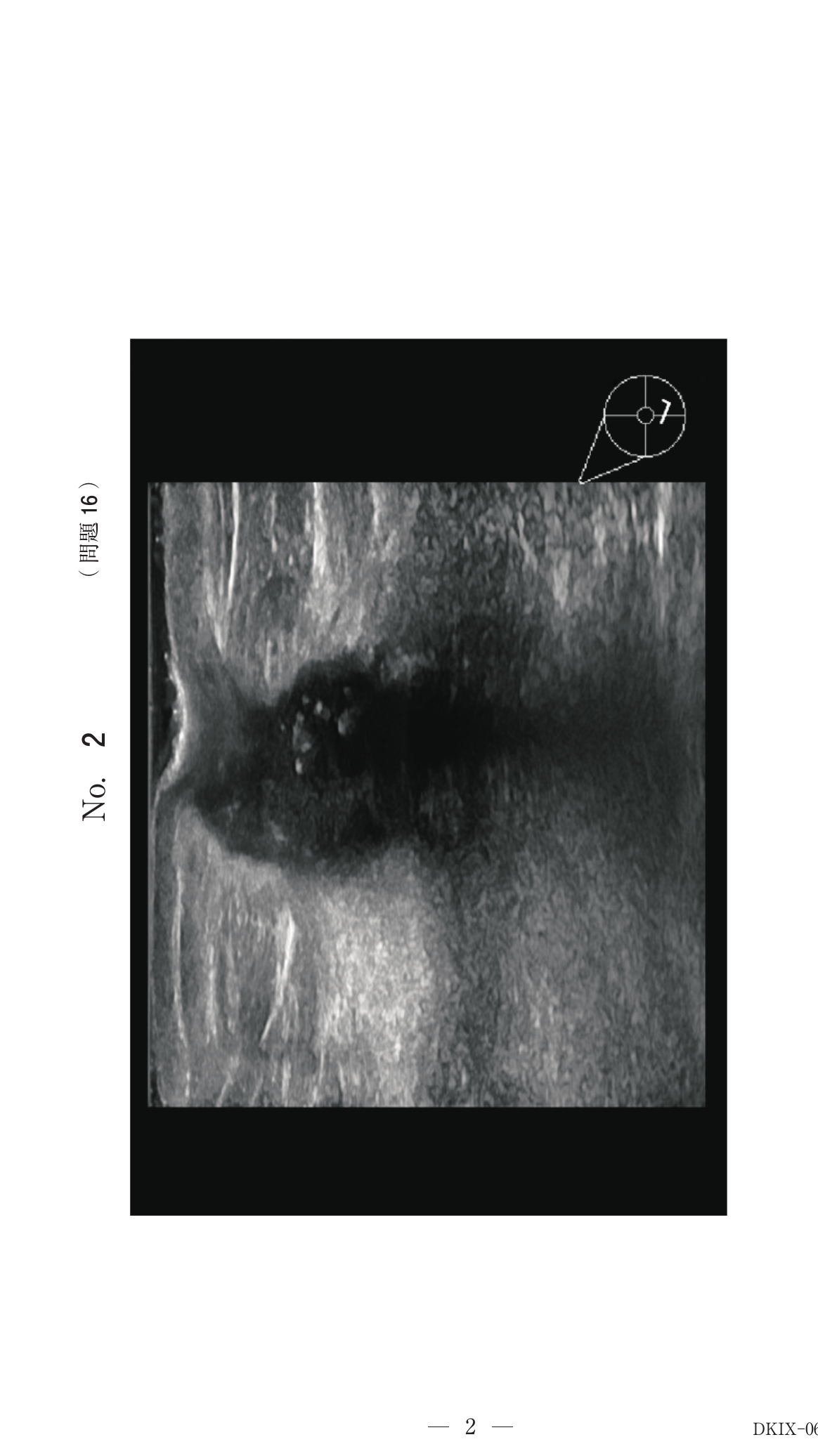 第74回 午前 問16 別冊 No. 2