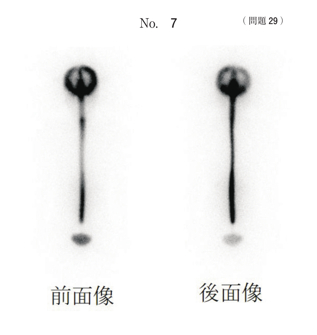 第74回 午前 問29 別冊 No. 7