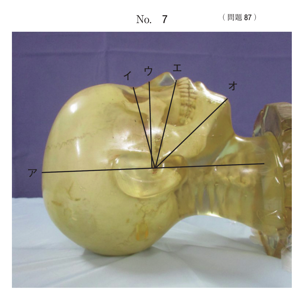 第76回 午後 問87 別冊 No. 7