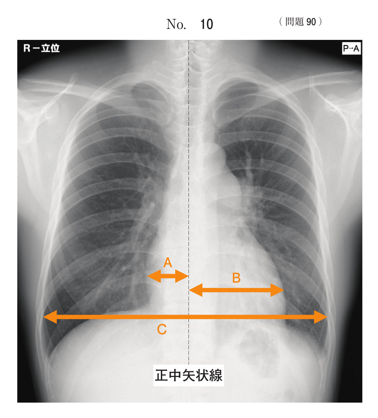 第78回 午前 問90 別冊 No. 10