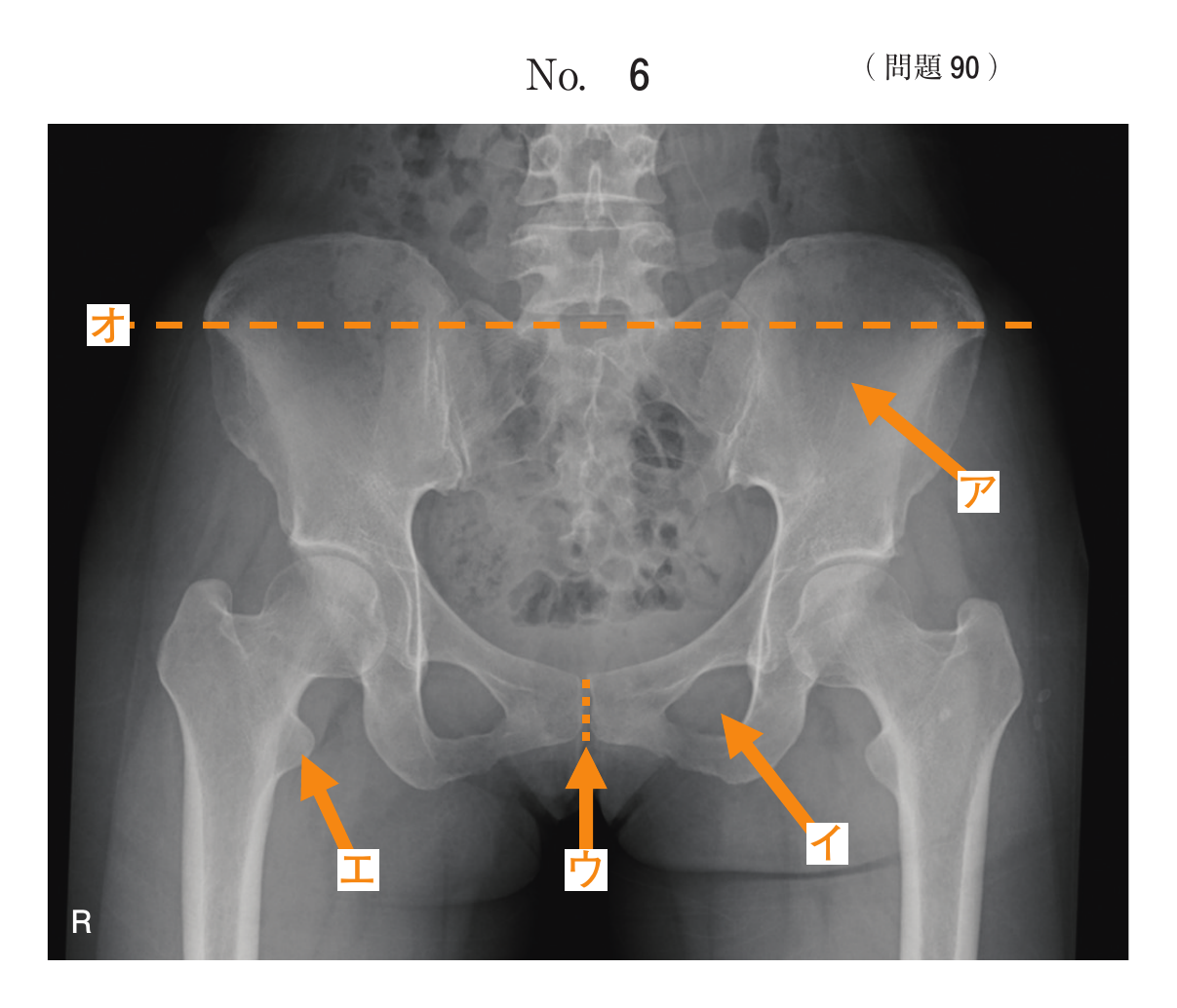 第78回 午後 問90 別冊 No. 6